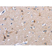 Immunohistochemical analysis of paraffin-embedded Human-brain tissue using FN1 antibody (1/50 dilution, X200).