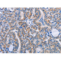 Fibronectin (FN1) Antibody