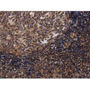 IHC-P analysis of Human Tonsil Tissue, using NTMT1 Antibody (1/40 dilution, 200x magnification).