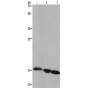 SDS-PAGE analysis of Raji cells (lane 1), Mouse liver tissue (lane 2) and Mouse heart tissue (lane 3) lysates (40 µg per lane) using Mitochondrial Fission 1 Protein (FIS1) antibody (1/500 dilution) followed by Goat anti-Rabbit IgG antibody (1/8000 dilution).