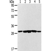 WB analysis of 293T cells (1), Mouse brain tissue (2), Human fetal liver tissue (3), HepG2 cells (4), and Jurkat cells (5), using Succinate Dehydrogenase Complex Subunit B Antibody (1/300 dilution) and Goat anti-Rabbit IgG antibody (1/8000 dilution).