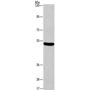 WB analysis of mouse brain tissue, using ARC antibody (1/597 dilution).