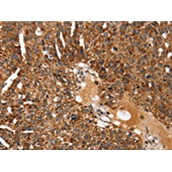 Potassium Voltage-Gated Channel Subfamily H Member 6 (KCNH6) Antibody