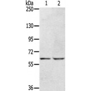 WB analysis of (1) HepG2 cells, and (2) HT29 cells, using KCNH6 Antibody (1/400 dilution) and goat anti-rabbit IgG secondary antibody (1/8000 dilution). Gel: 6% SDS-PAGE. Lysate: 40 µg. Exposure time: 30 s.