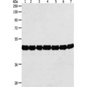 WB analysis (10% SDS-PAGE, 50 µg lysate) of (1) Cinnamomum camphora tissue, (2) Nicotiana tabacum tissue, (3) Triticum aestivum, (4) Arabidopsis thaliana leaves, (5) Brassica campestris flowers, (6) Brassica campestris, and (7) Vicit Faba leaves, using Actin-12 Antibody (1/500 dilution) and Goat anti-Rabbit IgG secondary antibody (1/8000 dilution). Exposure time: 20 seconds.