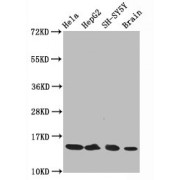 Western Blot<br/> Positive WB detected in: Hela whole cell lysate, HepG2 whole cell lysate, SH-SY5Y whole cell lysate, Rat brain tissue<br/> All lanes: Acetyl-Histone H3.1 (K14) antibody at 0.75 µg/ml<br/> Secondary<br/> Goat polyclonal to rabbit IgG at 1/50000 dilution<br/> Predicted band size: 15 KDa<br/> Observed band size: 15 KDa<br/>