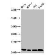 Western Blot<br/> Positive WB detected in: Hela whole cell lysate, MCF-7 whole cell lysate, 293 whole cell lysate, HepG2 whole cell lysate<br/> All lanes: Acetyl-Histone H4 (K5) antibody at 1.05 µg/ml<br/> Secondary<br/> Goat polyclonal to rabbit IgG at 1/50000 dilution<br/> Predicted band size: 11 KDa<br/> Observed band size: 11 KDa<br/>