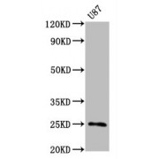 Western Blot<br/> Positive WB detected in: U87 whole cell lysate<br/> All lanes: CD9 antibody at 0.55 µg/ml<br/> Secondary<br/> Goat polyclonal to rabbit IgG at 1/50000 dilution<br/> Predicted band size: 25 KDa<br/> Observed band size: 25 KDa<br/>