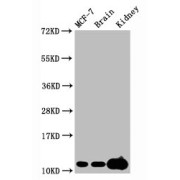 Western Blot<br/> Positive WB detected in: MCF-7 whole cell lysate, Mouse brain tissue, Mouse kidney tissue<br/> All lanes: Tri-methyl-Histone H4 (K20) antibody at 2.15 µg/ml<br/> Secondary<br/> Goat polyclonal to rabbit IgG at 1/50000 dilution<br/> Predicted band size: 11 KDa<br/> Observed band size: 11 KDa<br/>