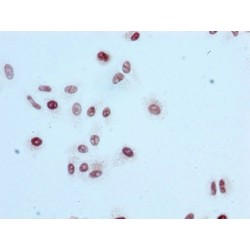 Histone H3.1 Acetyl-Lys56 (H3C1 AcK56) Antibody