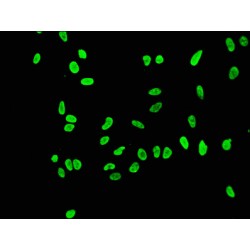 Histone H3.1 Acetyl-Lys56 (H3C1 AcK56) Antibody