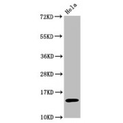 Western Blot<br/> Positive WB detected in: Hela whole cell lysate treated by 15mM sodium butyrate for 30min<br/> All lanes: Acetyl-Histone H3.1 (K56) antibody at 0.7 µg/ml<br/> Secondary<br/> Goat polyclonal to rabbit IgG at 1/50000 dilution<br/> Predicted band size: 15 KDa<br/> Observed band size: 15 KDa<br/>