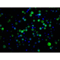 Complement Receptor 2 / CD21 (CR2) Antibody