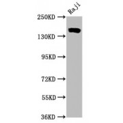 Western Blot<br/> Positive WB detected in: Raji whole cell lysate<br/> All lanes: CD21 antibody at 0.55 µg/ml<br/> Secondary<br/> Goat polyclonal to rabbit IgG at 1/50000 dilution<br/> Predicted band size: 155 KDa<br/> Observed band size: 155 KDa<br/>