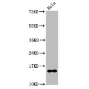 Western Blot<br/> Positive WB detected in: Hela whole cell lysate treated by 15mM sodium butyrate for 30min<br/> All lanes: Acetyl-Histone H2B type 1-B (K20) antibody at 0.135 µg/ml<br/> Secondary<br/> Goat polyclonal to rabbit IgG at 1/50000 dilution<br/> Predicted band size: 15 KDa<br/> Observed band size: 15 KDa<br/>