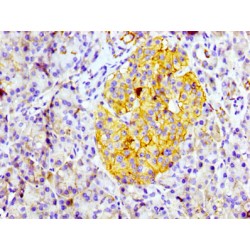 Cluster of Differentiation 99 (CD99) Antibody