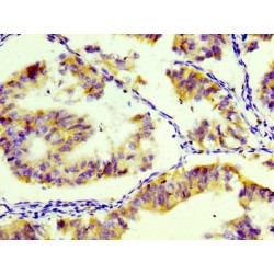 HLA Class II Histocompatibility Antigen Gamma Chain (CD74) Antibody