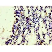 Immunohistochemistry analysis of CD163 Antibody diluted at 1/100 and staining in paraffin-embedded human lung tissue. After dewaxing and hydration, antigen retrieval was mediated by high pressure in a citrate buffer (pH 6.0). Section was blocked with 10% normal goat serum 30min at RT. Then primary antibody (1% BSA) was incubated at 4°C overnight. The primary is detected by a biotinylated secondary antibody and visualized using an HRP conjugated SP system.