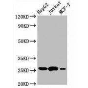 Western Blot<br/> Positive WB detected in: HepG2 whole cell lysate, Jurkat whole cell lysate, MCF-7 whole cell lysate<br/> All lanes: BCL2 antibody at 1 µg/ml<br/> Secondary<br/> Goat polyclonal to rabbit IgG at 1/50000 dilution<br/> Predicted band size: 26 KDa<br/> Observed band size: 26 KDa<br/>