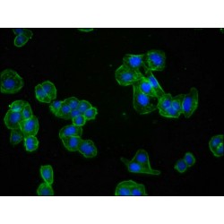 Actin (ACTA1) Antibody