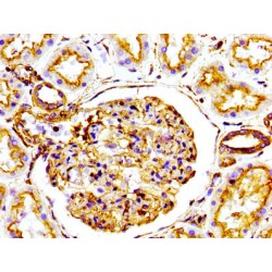 Actin (ACTA1) Antibody