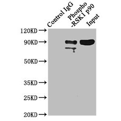 RPS6KA1 (pT359+pS363) Antibody