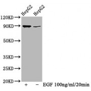Western Blot<br/> Positive WB detected in: HepG2 whole cell lysate (treated with EGF or not)<br/> All lanes: Phospho-RPS6KA1 antibody at 0.69 µg/ml<br/> Secondary<br/> Goat polyclonal to rabbit IgG at 1/50000 dilution<br/> Predicted band size: 90 KDa<br/> Observed band size: 90 KDa<br/>