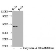 Western Blot<br/> Positive WB detected in: Hela whole cell lysate (treated with Calyculin A or not)<br/> All lanes: Phospho-IRF3 antibody at 1.03 µg/ml<br/> Secondary<br/> Goat polyclonal to rabbit IgG at 1/50000 dilution<br/> Predicted band size: 47 KDa<br/> Observed band size: 47 KDa<br/>