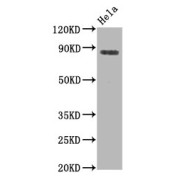 Western Blot<br/> Positive WB detected in: Hela whole cell lysate<br/> All lanes: Phospho-HSF1 antibody at 0.8 µg/ml<br/> Secondary<br/> Goat polyclonal to rabbit IgG at 1/50000 dilution<br/> Predicted band size: 82 KDa<br/> Observed band size: 82 KDa<br/>
