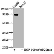 Western Blot<br/> Positive WB detected in: HepG2 whole cell lysate (treated with EGF or not)<br/> All lanes: Phospho-STAT5A antibody at 1.025 µg/ml<br/> Secondary<br/> Goat polyclonal to rabbit IgG at 1/50000 dilution<br/> Predicted band size: 90 KDa<br/> Observed band size: 90 KDa<br/>