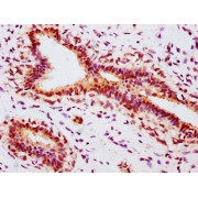 abx242989