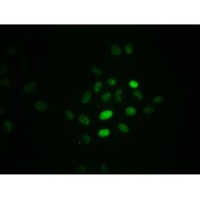 Immunofluorescence staining of Hela cells using RPA2 (pT21) Antibody at 1/100, counter-stained with DAPI. The cells were fixed in 4% formaldehyde, permeabilized using 0.2% Triton X-100 and blocked in 10% normal Goat Serum. The cells were then incubated with the antibody overnight at 4°C. The secondary antibody was AF488-congugated AffiniPure Goat Anti-Rabbit IgG (H+L).