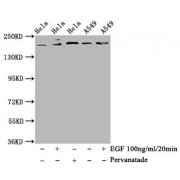 Western Blot<br/> Positive WB detected in: Hela whole cell lysate, A549 whole cell lysate (treated with EGF or Pervanadate)<br/> All lanes: Phospho-PDGFRB antibody at 1.14 µg/ml<br/> Secondary<br/> Goat polyclonal to rabbit IgG at 1/50000 dilution<br/> Predicted band size: 190 KDa<br/> Observed band size: 190 KDa<br/>