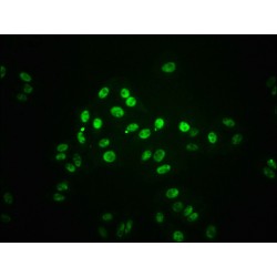 Signal Transducer And Activator of Transcription 1 Phospho-Ser727 (STAT1 pS727) Antibody