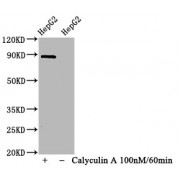 WB analysis of HepG2 whole cell lysates (1) treated with Calyculin A, and (2) not treated with Calyculin A, using STAT1 pS727 Antibody (1.065 µg/ml) and Goat anti-rabbit IgG secondary antibody (1/50000 dilution). Predicted band size: 87 kDa, Observed band size: 87 kDa<br/>