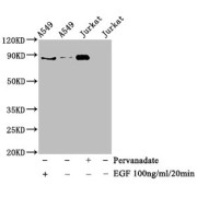 Western Blot<br/> Positive WB detected in: A549 whole cell lysate,Jurkat whole cell lysate (treated with EGF or Pervanadate)<br/> All lanes: Phospho-STAT3 antibody at 0.925 µg/ml<br/> Secondary<br/> Goat polyclonal to rabbit IgG at 1/50000 dilution<br/> Predicted band size: 88 KDa<br/> Observed band size: 88 KDa<br/>