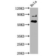 Western Blot<br/> Positive WB detected in: Hela whole cell lysate<br/> All lanes: Phospho-AKT1 antibody at 2.25µg/ml<br/> Secondary<br/> Goat polyclonal to rabbit IgG at 1/50000 dilution<br/> Predicted band size: 60 KDa<br/> Observed band size: 60 KDa<br/>
