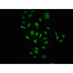 RAF1 (pS621) Antibody