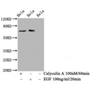 Western Blot<br/> Positive WB detected in: Hela whole cell lysate (treated with Calyculin A or EGF)<br/> All lanes: Phospho-RAF1 antibody at 1.525 µg/ml<br/> Secondary<br/> Goat polyclonal to rabbit IgG at 1/50000 dilution<br/> Predicted band size: 73 KDa<br/> Observed band size: 73 KDa<br/>