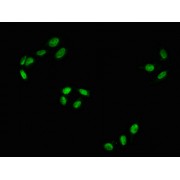 Immunofluorescence staining of Hela using RAF1 (pS43) Antibody at 1/100,counter-stained with DAPI. The cells were fixed in 4% formaldehyde, permeabilized using 0.2% Triton X-100 and blocked in 10% normal Goat Serum. The cells were then incubated with the antibody overnight at 4°C. The secondary antibody was AF488-congugated AffiniPure Goat Anti-Rabbit IgG (H+L).