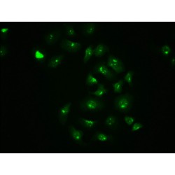 JUN (pS63) Antibody
