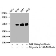 Western Blot<br/> Positive WB detected in: Hela whole cell lysate, A549 whole cell lysate(treated with Calyculin A or EGF)<br/> All lanes: Phospho-JUN antibody at 0.95 µg/ml<br/> Secondary<br/> Goat polyclonal to rabbit IgG at 1/50000 dilution<br/> Predicted band size: 48 KDa<br/> Observed band size: 48 KDa<br/>