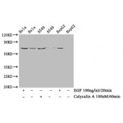 Western Blot<br/> Positive WB detected in: Hela whole cell lysate, A549 whole cell lysate, HepG2 whole cell lysate (treated with Calyculin A or EGF)<br/> All lanes: Phospho-PXN antibody at 1.43 µg/ml<br/> Secondary<br/> Goat polyclonal to rabbit IgG at 1/50000 dilution<br/> Predicted band size: 68 KDa<br/> Observed band size: 68 KDa<br/>