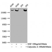 Western Blot<br/> Positive WB detected in: A549 whole cell lysate, 293 whole cell lysate (treated with Calyculin A or EGF)<br/> All lanes: Phospho-MTOR antibody at 1.33 µg/ml<br/> Secondary<br/> Goat polyclonal to rabbit IgG at 1/50000 dilution<br/> Predicted band size: 289 KDa<br/> Observed band size: 289 KDa<br/>