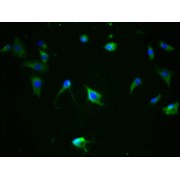 Immunofluorescence staining of SH-SY5Y cells using MAPT (pS324) Antibody at 1/100,counter-stained with DAPI. The cells were fixed in 4% formaldehyde, permeabilized using 0.2% Triton X-100 and blocked in 10% normal Goat Serum. The cells were then incubated with the antibody overnight at 4°C. The secondary antibody was AF488-congugated AffiniPure Goat Anti-Rabbit IgG (H+L).