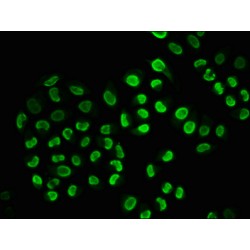 SNCA (pS129) Antibody