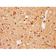 Immunocytochemistry analysis of diluted at 1/100 and staining in paraffin-embedded human brain tissue. After dewaxing and hydration, antigen retrieval was mediated by high pressure in a citrate buffer (pH 6.0). Section was blocked with 10% normal goat serum 30min at RT. Then primary antibody (1% BSA) was incubated at 4°C overnight. The primary is detected by a biotinylated secondary antibody and visualized using an HRP conjugated SP system.