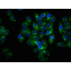 LAT (pY191) Antibody