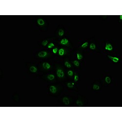 MTOR (pS2448) Antibody