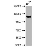 Western Blot<br/> Positive WB detected in: Hela whole cell lysate<br/> All lanes: Phospho-PTK2 antibody at 3.05 µg/ml<br/> Secondary<br/> Goat polyclonal to rabbit IgG at 1/50000 dilution<br/> Predicted band size: 119 KDa<br/> Observed band size: 119 KDa<br/>
